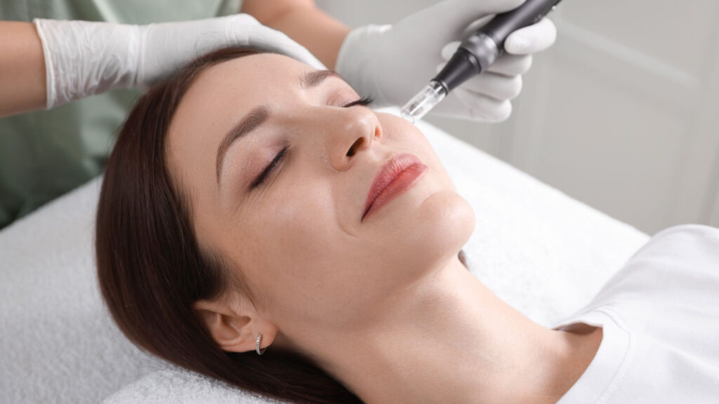 rf-microneedling-behadlung-bild