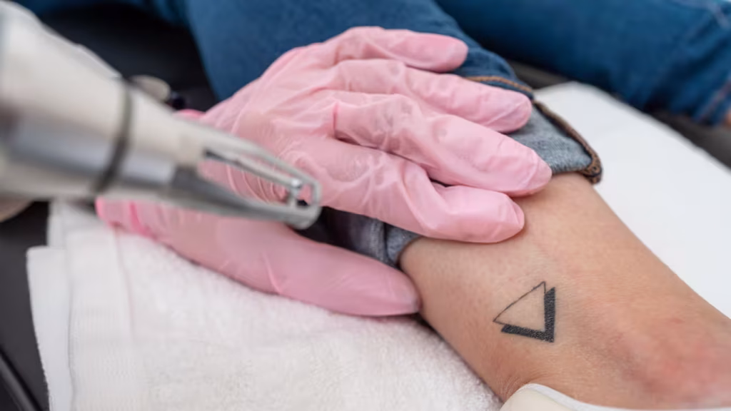 phiremoval-bild